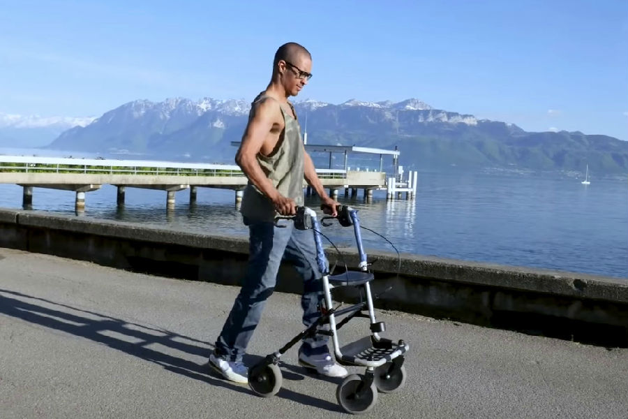 硬膜外电刺激技术可令瘫痪病人重新行走