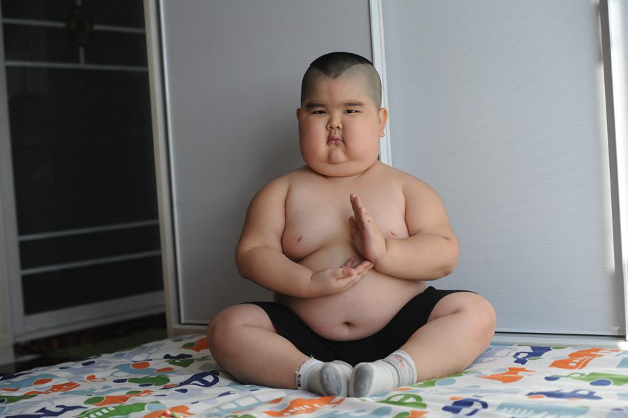 长春5岁肥胖男童活似